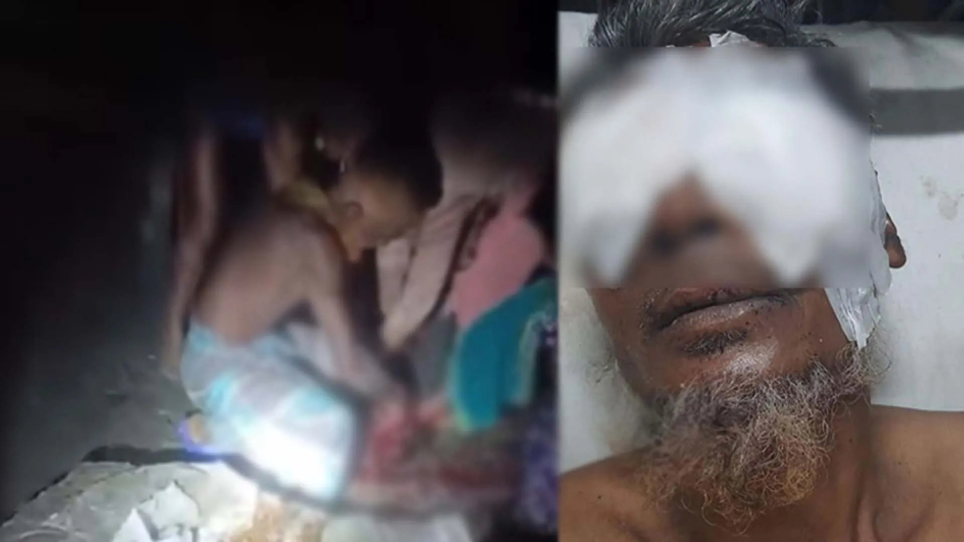 বরিশালে ভাইয়ের চোখ উঠিয়ে নেয়ার ঘটনায় অভিযুক্ত এক ভাই গ্রেপ্তার